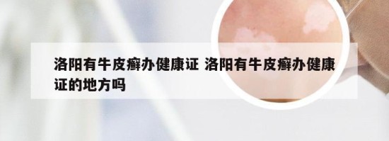 洛陽有牛皮癬辦健康證 洛陽有牛皮癬辦健康證的地方嗎